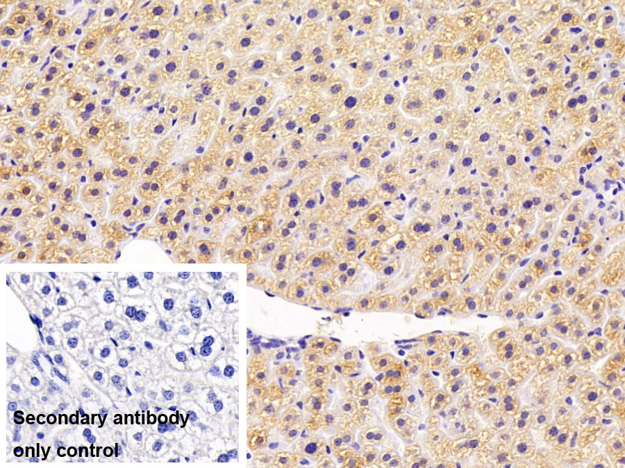 Polyclonal Antibody to Acetoacetyl Coenzyme A Synthetase (AACS)