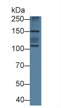 Polyclonal Antibody to ATPase, Na+/K+ Transporting Alpha 1 Polypeptide (ATP1a1)