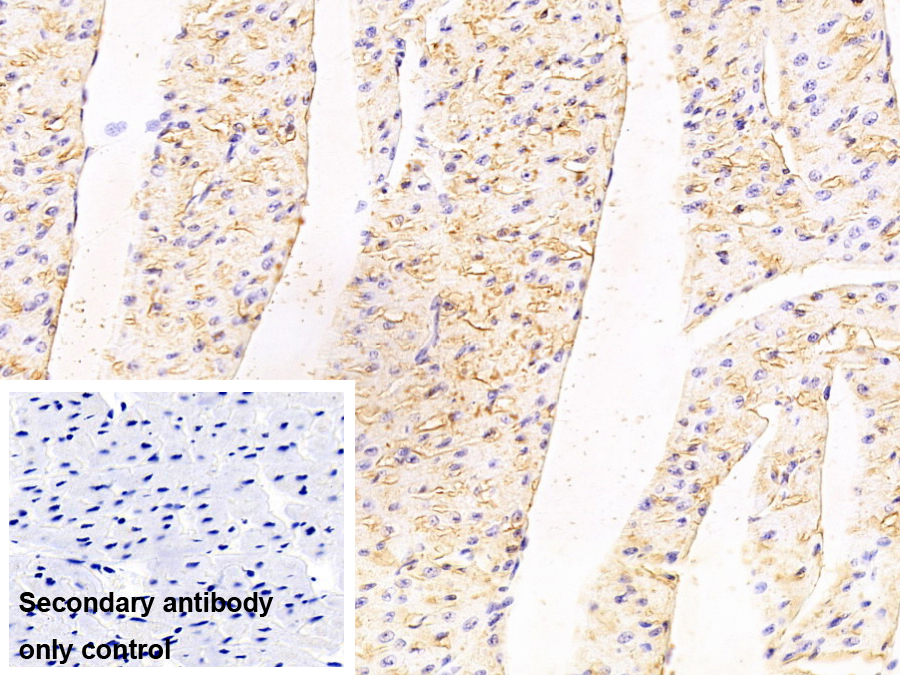 Polyclonal Antibody to ATPase, Na+/K+ Transporting Alpha 1 Polypeptide (ATP1a1)