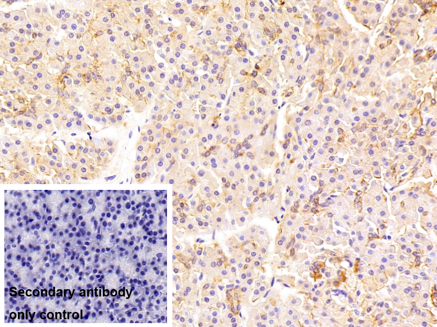 Polyclonal Antibody to ATPase, Na+/K+ Transporting Alpha 1 Polypeptide (ATP1a1)