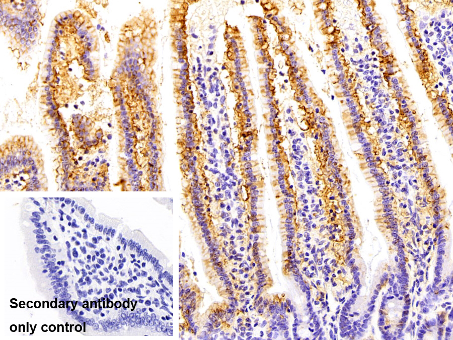 Polyclonal Antibody to ATPase, Na+/K+ Transporting Alpha 1 Polypeptide (ATP1a1)