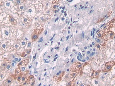 Polyclonal Antibody to ATPase, H+ Transporting, Lysosomal Accessory Protein 2 (ATP6AP2)