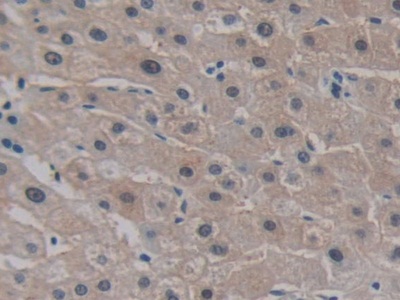 Polyclonal Antibody to Cadherin EGF LAG Seven Pass G-Type Receptor 3 (CELSR3)