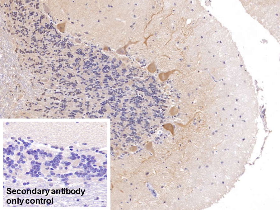 Polyclonal Antibody to Calbindin (CALB)