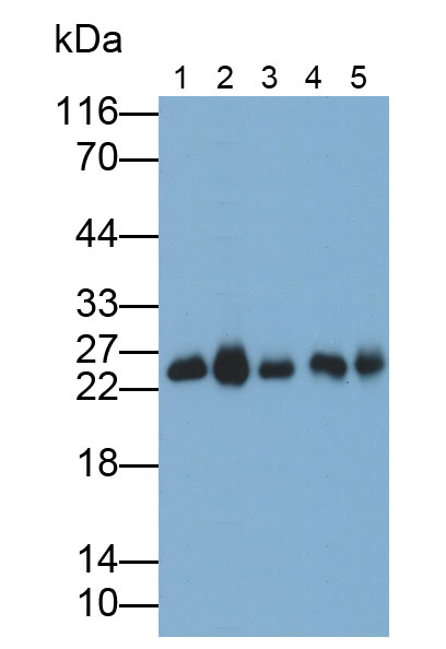 Polyclonal Antibody to Calbindin (CALB)