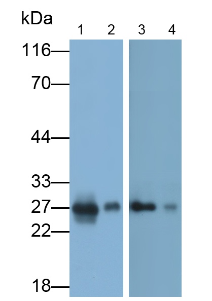 Polyclonal Antibody to Calbindin (CALB)