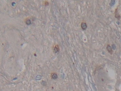 Polyclonal Antibody to Cerebral Dopamine Neurotrophic Factor (CDNF)