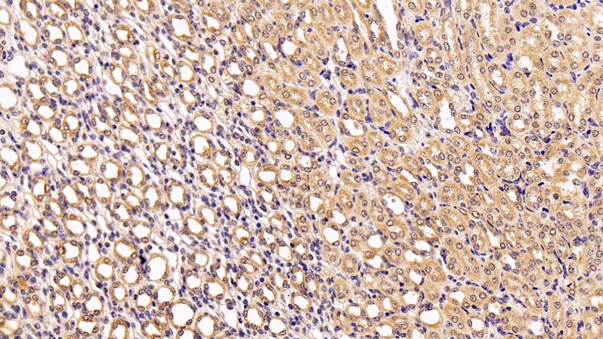 Polyclonal Antibody to Betaine Homocysteine Methyltransferase 2 (BHMT2)