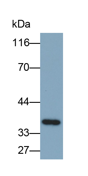Polyclonal Antibody to Microtubule Associated Protein RP/EB Family, Member 1 (MAPRE1)