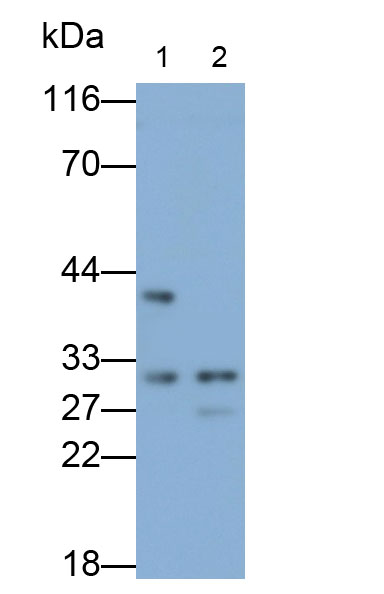 Polyclonal Antibody to Microtubule Associated Protein RP/EB Family, Member 1 (MAPRE1)