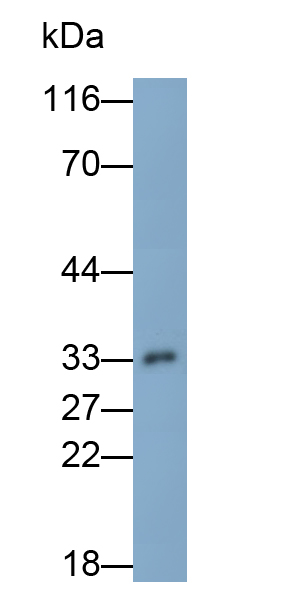 Polyclonal Antibody to Microtubule Associated Protein RP/EB Family, Member 1 (MAPRE1)