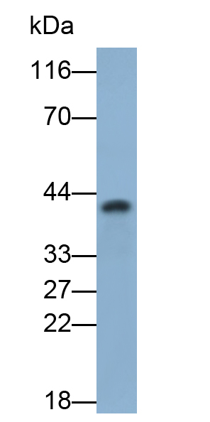 Polyclonal Antibody to Guanine Nucleotide Binding Protein Q Polypeptide (GNAQ)