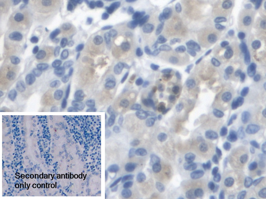 Polyclonal Antibody to Arylsulfatase A (ARSA)