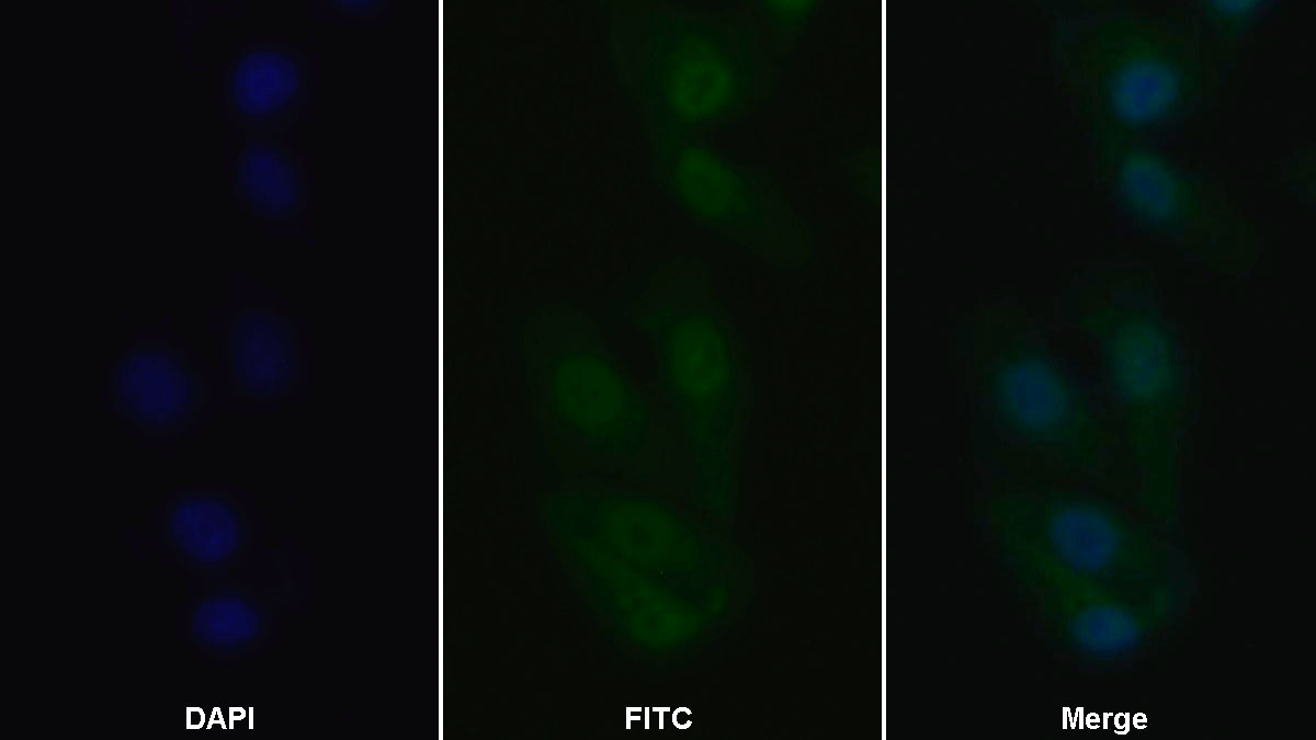 Polyclonal Antibody to TNF Receptor Associated Factor 6 (TRAF6)