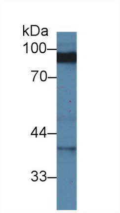 Polyclonal Antibody to Discs, Large Homolog 3 (DLG3)