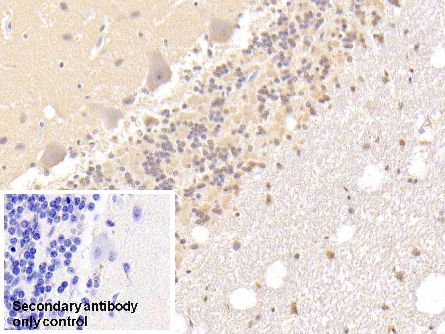 Polyclonal Antibody to Discs, Large Homolog 3 (DLG3)