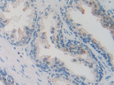 Polyclonal Antibody to Secretagogin (SCGN)