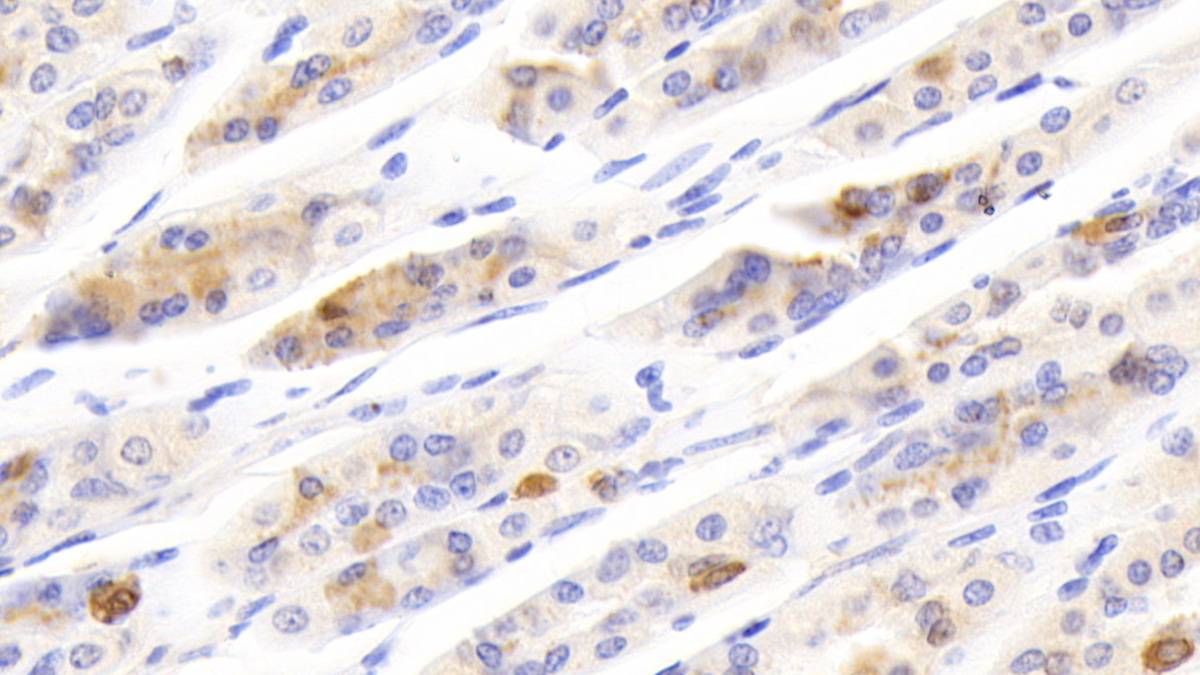 Polyclonal Antibody to Secretagogin (SCGN)