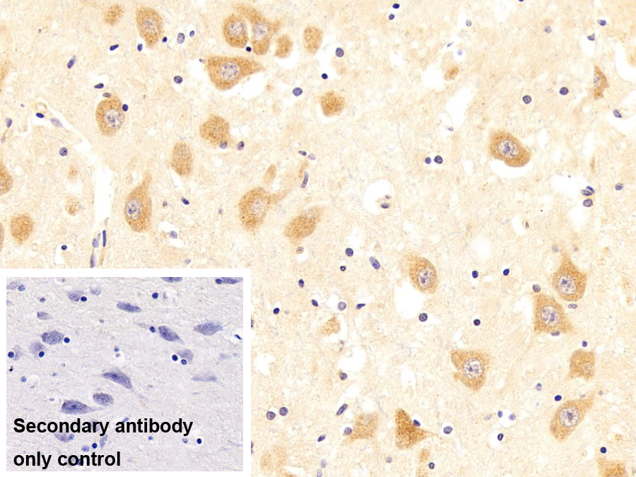Polyclonal Antibody to Polyribonucleotide Nucleotidyltransferase 1 (PNPT1)