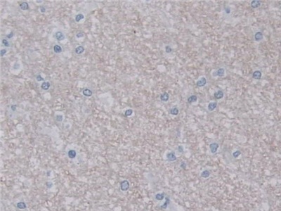 Polyclonal Antibody to Uracil DNA Glycosylase (UNG)