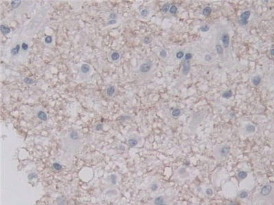 Polyclonal Antibody to Uracil DNA Glycosylase (UNG)