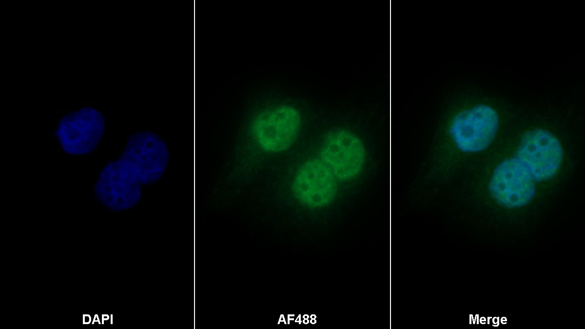 Polyclonal Antibody to Uracil DNA Glycosylase (UNG)