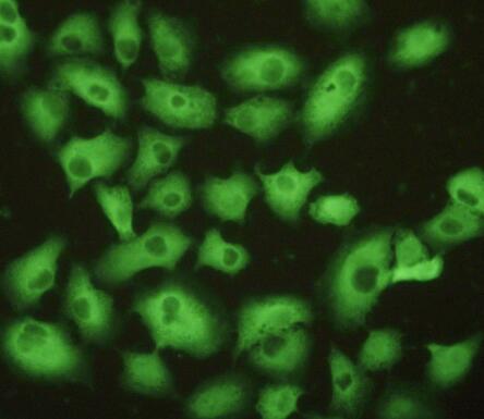 Polyclonal Antibody to Ubiquitin Carboxyl Terminal Hydrolase L1 (UCHL1)