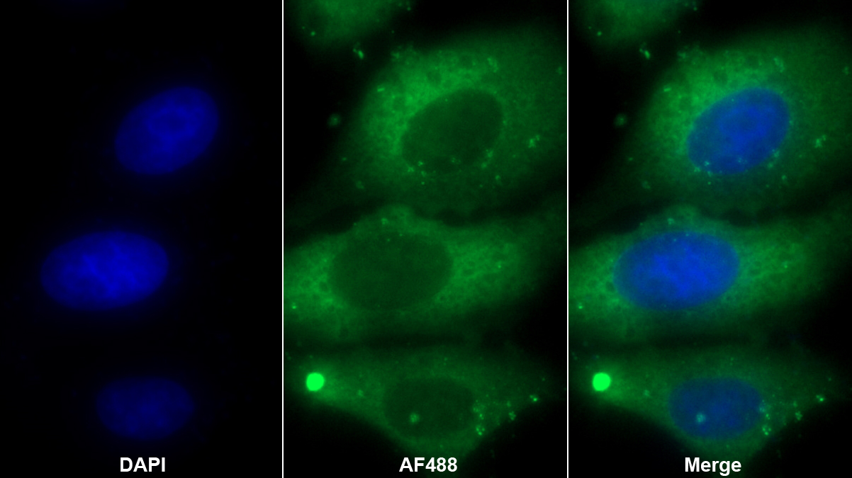 Polyclonal Antibody to Tumor Protein, Translationally Controlled 1 (TPT1)