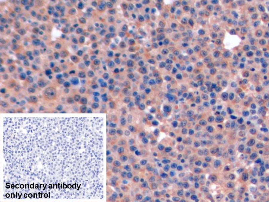 Polyclonal Antibody to Thymidylate Synthetase (TYMS)