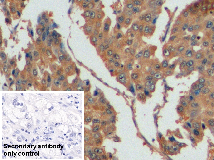 Polyclonal Antibody to Thymidylate Synthetase (TYMS)