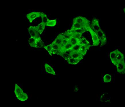 Polyclonal Antibody to TTK Protein Kinase (TTK)