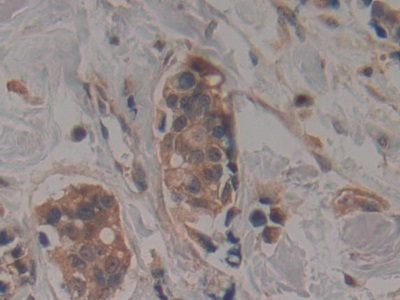 Polyclonal Antibody to TTK Protein Kinase (TTK)