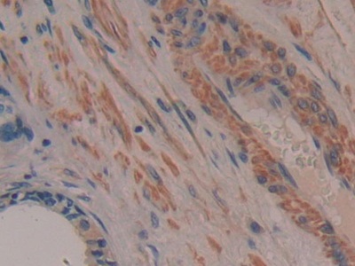 Polyclonal Antibody to TTK Protein Kinase (TTK)