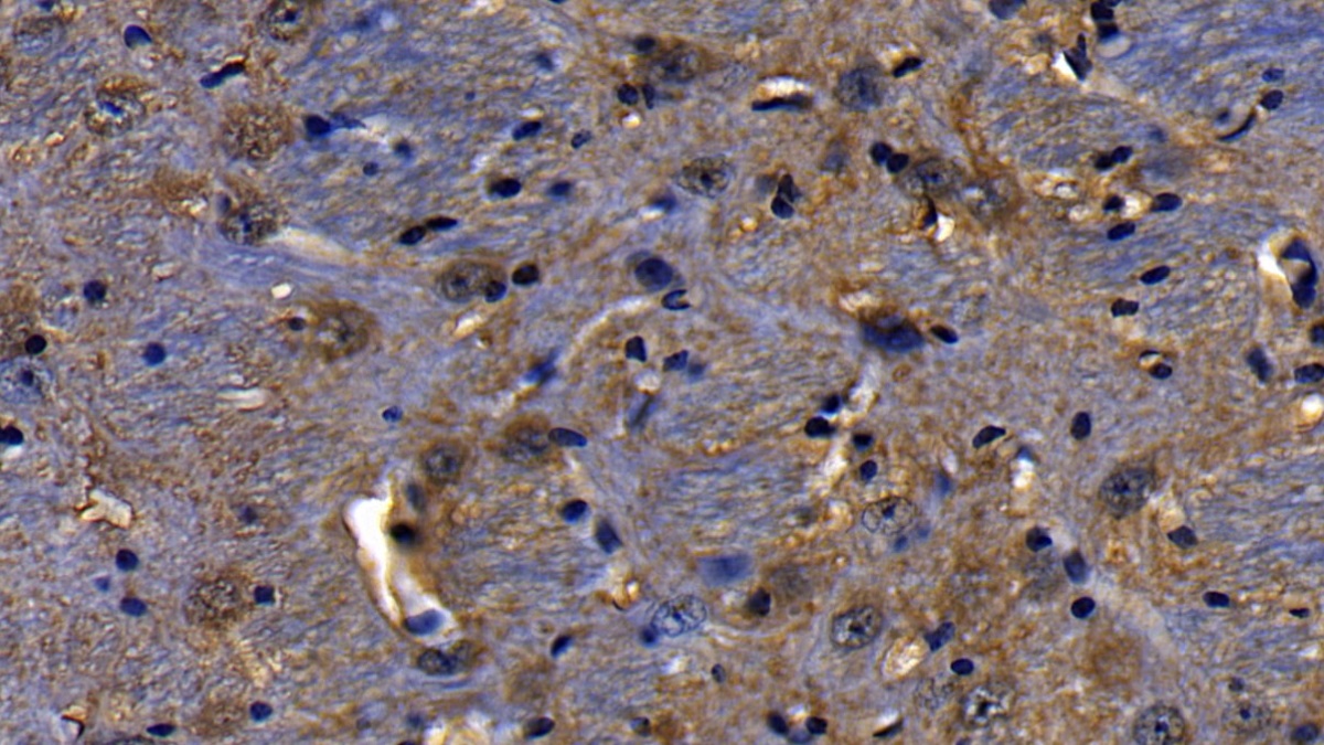Polyclonal Antibody to Toll Like Receptor Adaptor Molecule 1 (TICAM1)
