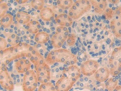 Polyclonal Antibody to Transforming Growth Factor Beta 1 Induced Transcript 1 (TGFb1I1)