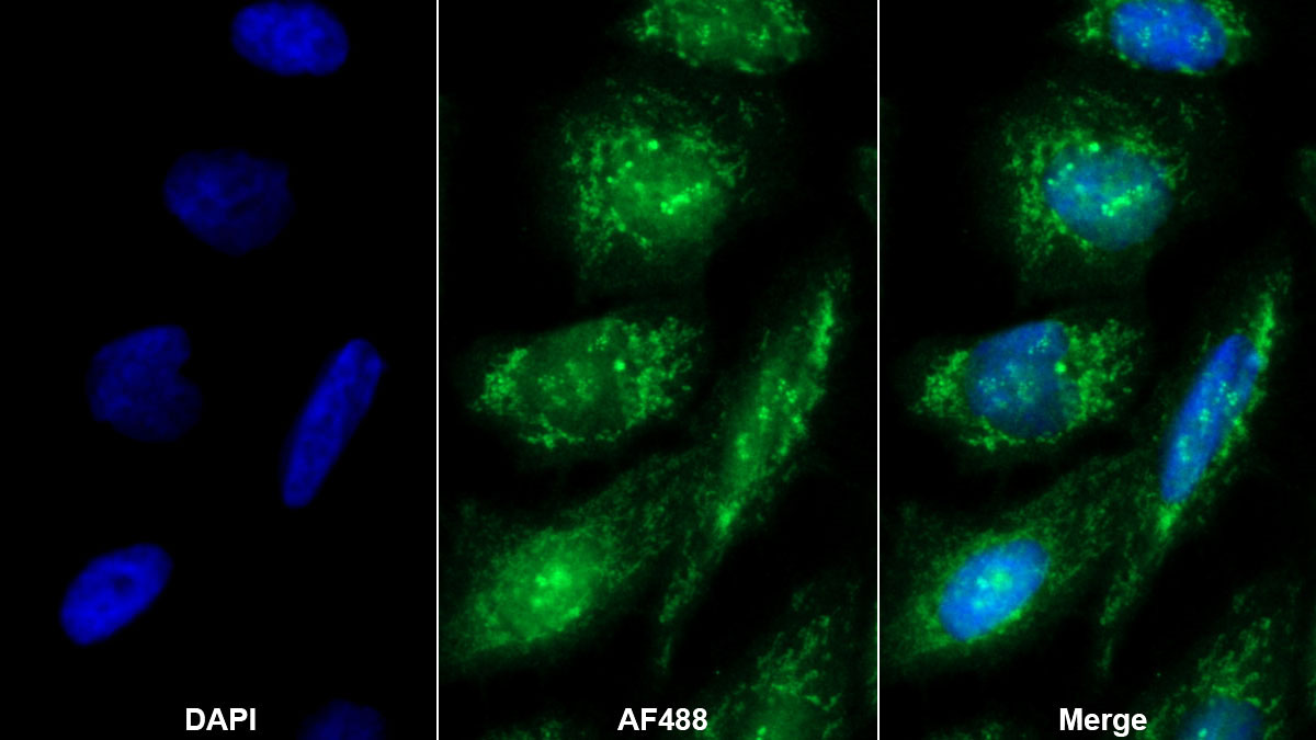Polyclonal Antibody to Sulfatase 2 (SULF2)