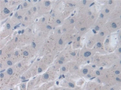 Polyclonal Antibody to Stress Induced Phosphoprotein 1 (STIP1)