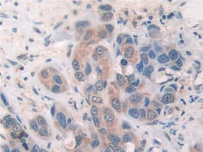 Polyclonal Antibody to Suppressors Of Cytokine Signaling 2 (SOCS2)