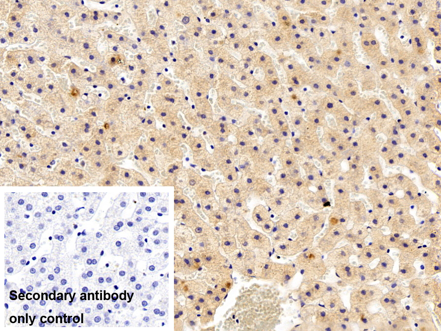 Polyclonal Antibody to SET Binding Protein 1 (SETBP1)