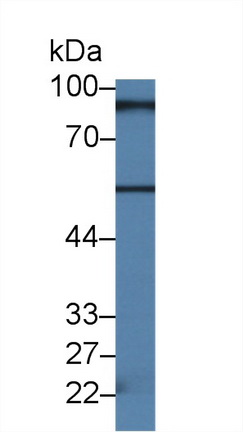 Polyclonal Antibody to RalA Binding Protein 1 (RALBP1)