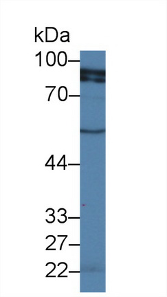 Polyclonal Antibody to RalA Binding Protein 1 (RALBP1)