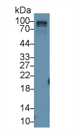 Polyclonal Antibody to RalA Binding Protein 1 (RALBP1)