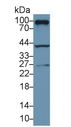 Polyclonal Antibody to RalA Binding Protein 1 (RALBP1)