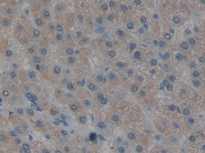 Polyclonal Antibody to Renal Tumor Antigen (RAGE)