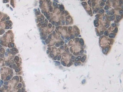 Polyclonal Antibody to Renal Tumor Antigen (RAGE)