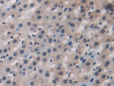 Polyclonal Antibody to Renal Tumor Antigen (RAGE)