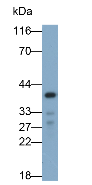 Polyclonal Antibody to Glutaminyl Peptide Cyclotransferase (QPCT)