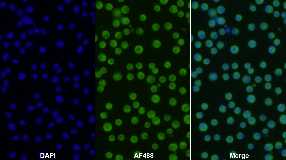 Polyclonal Antibody to Glutaminyl Peptide Cyclotransferase (QPCT)