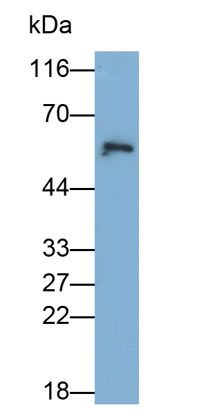 Polyclonal Antibody to Prolactin Receptor (PRLR)