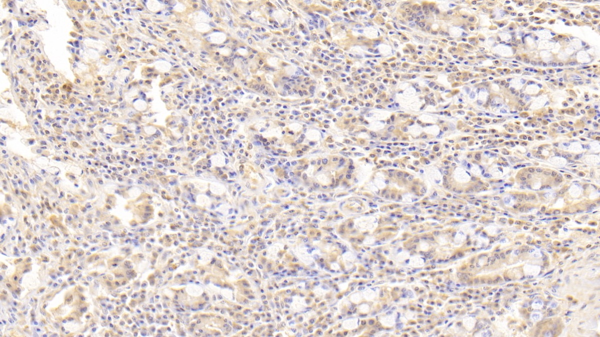 Polyclonal Antibody to Preferentially Expressed Antigen In Melanoma (PRAME)